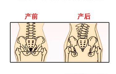 月子期间盆骨仪器修复时间有限制吗？与手法修复相比哪个效果好？